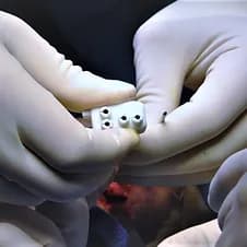 CORRECTIVE OSTEOTOMY