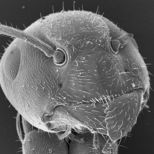 Scanning electron microscopy