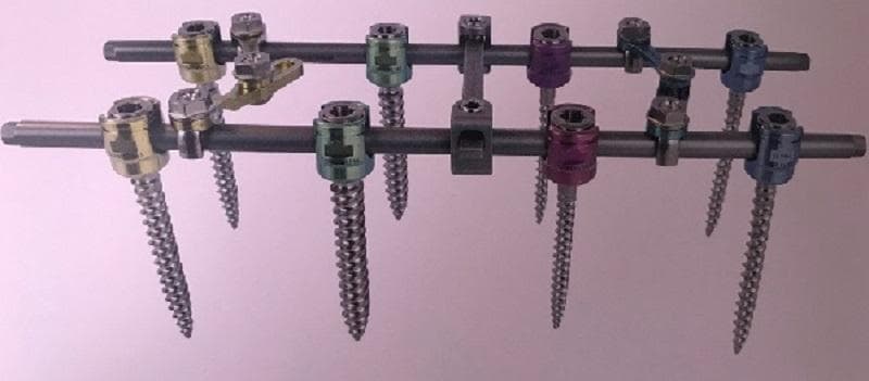 spinal fixastion systems