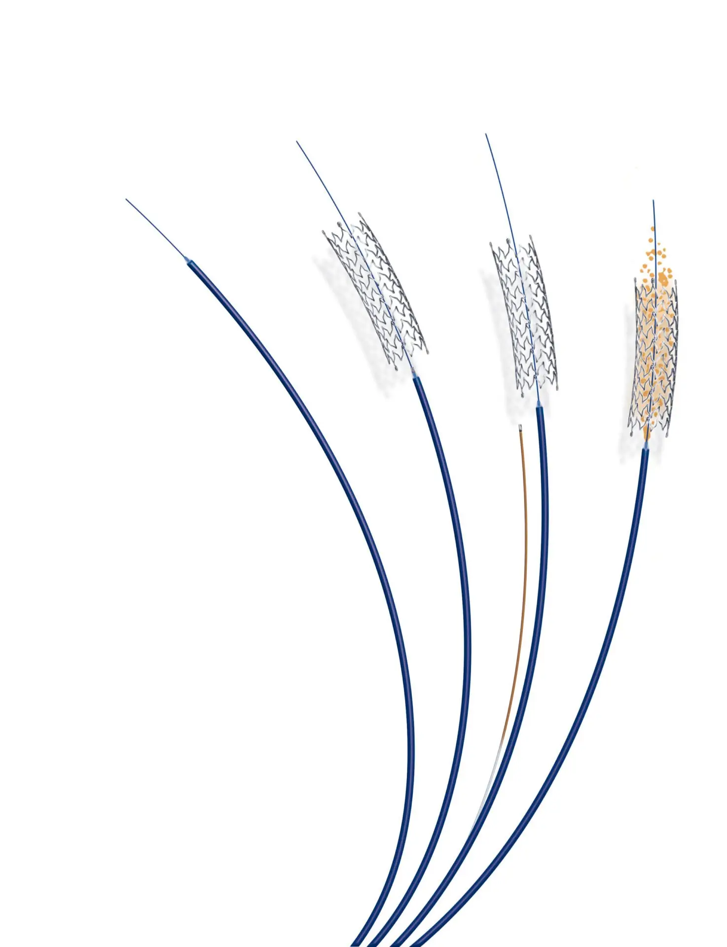 STENTS FOR THE TREATMENT OF FEMORAL ARTERIES