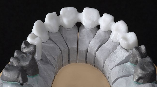 الأطراف الاصطناعية للأسنان